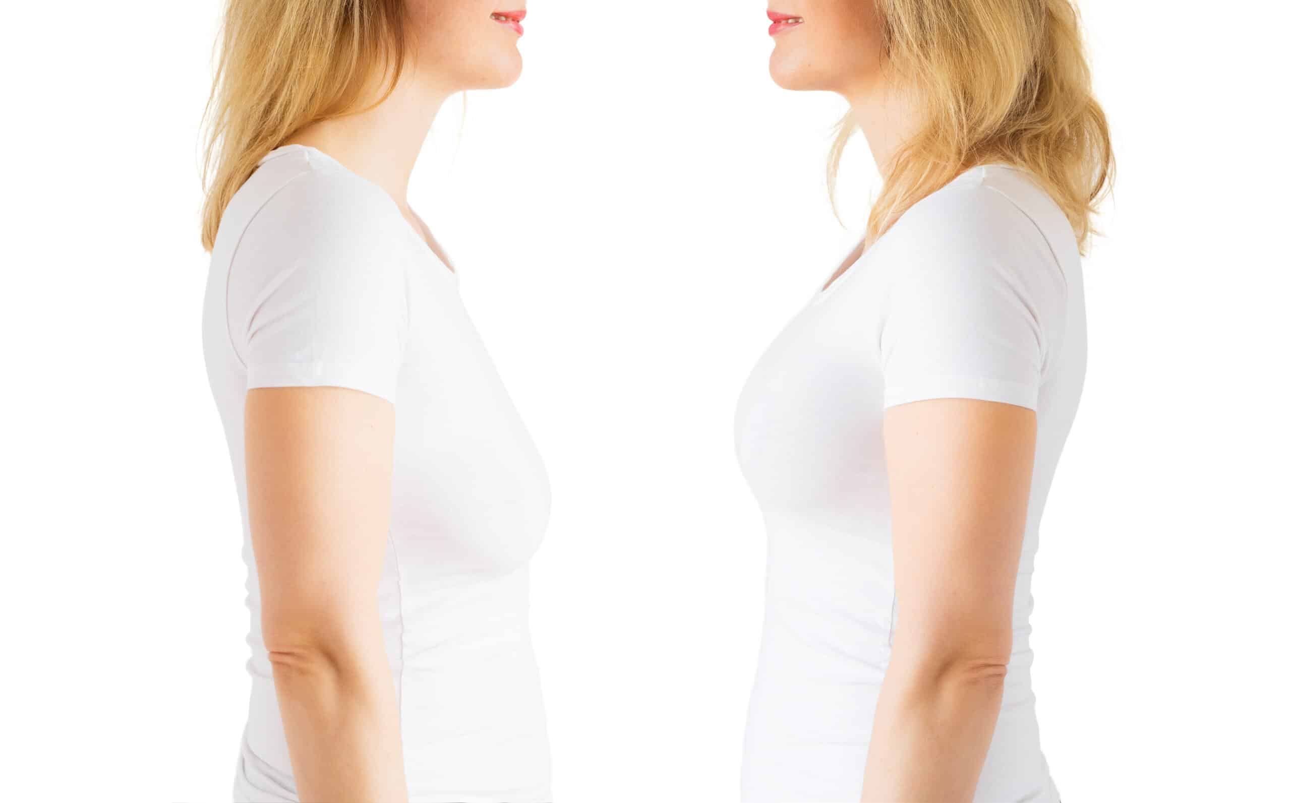 Understanding the Three Breast Lift Techniques