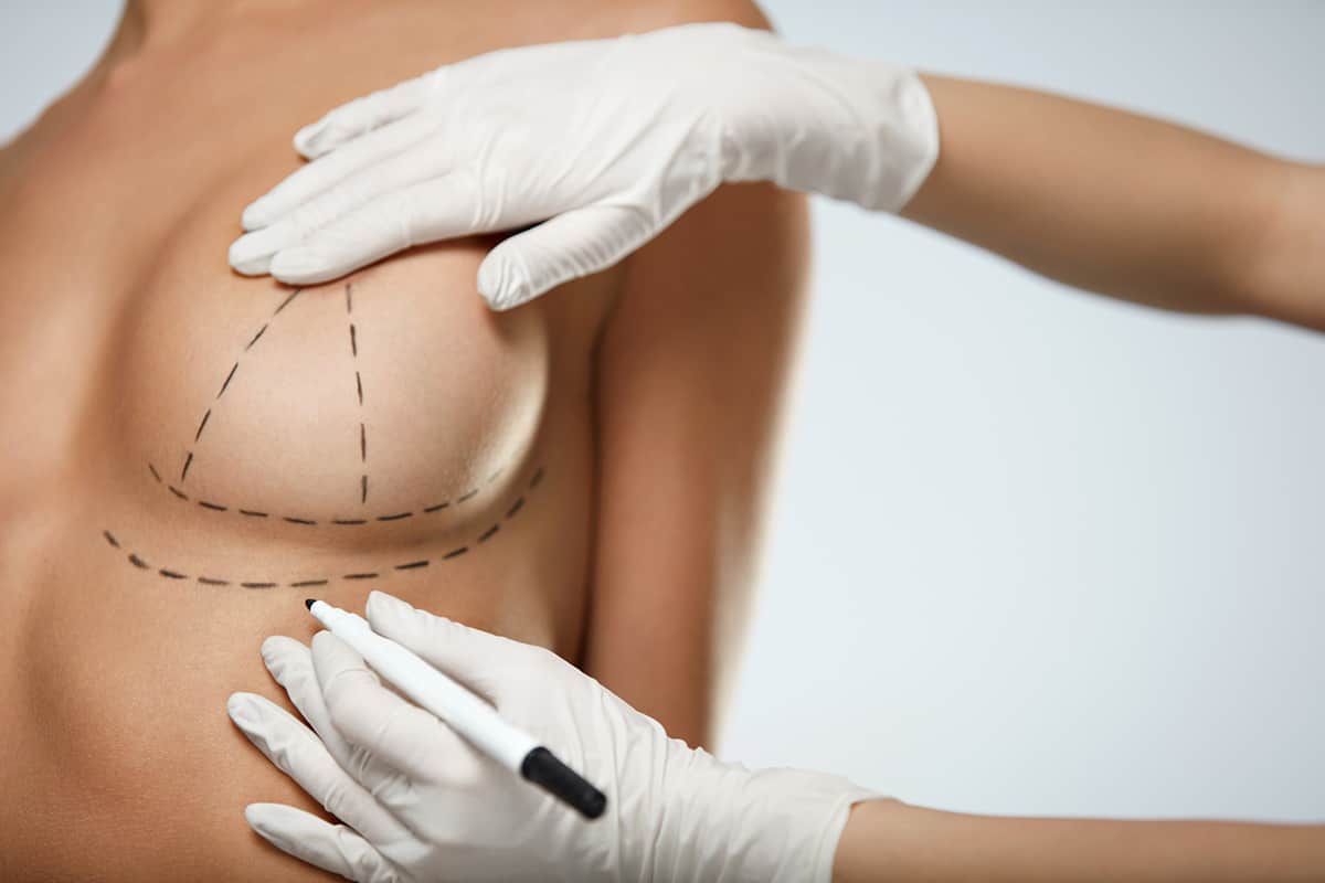 Can Breasts be too Saggy for a Breast Lift?